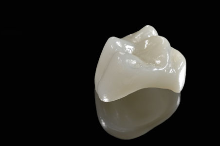 Dental Crowns