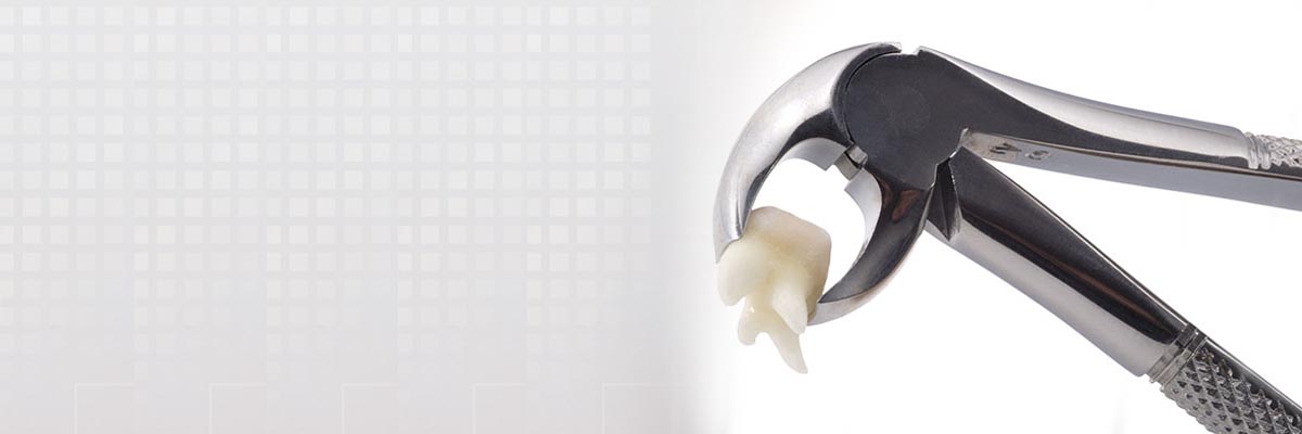 Houston Tooth Extraction