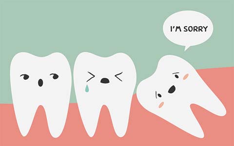 Wisdom Teeth Extraction